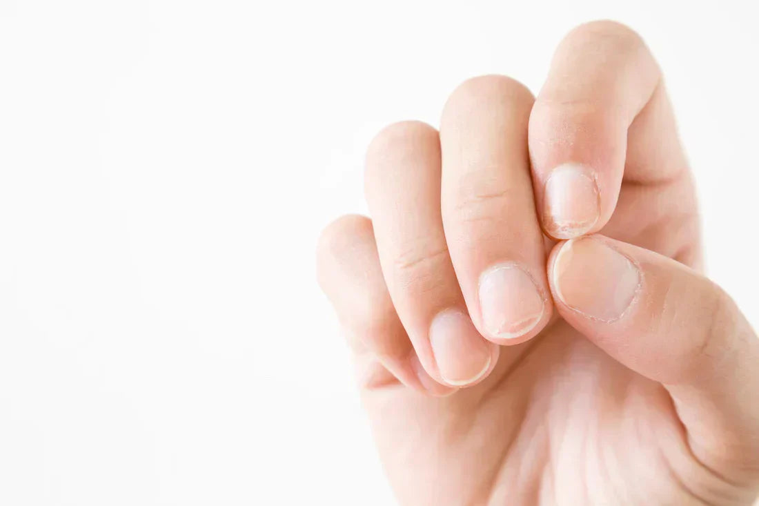How to Harden Your Fingernails